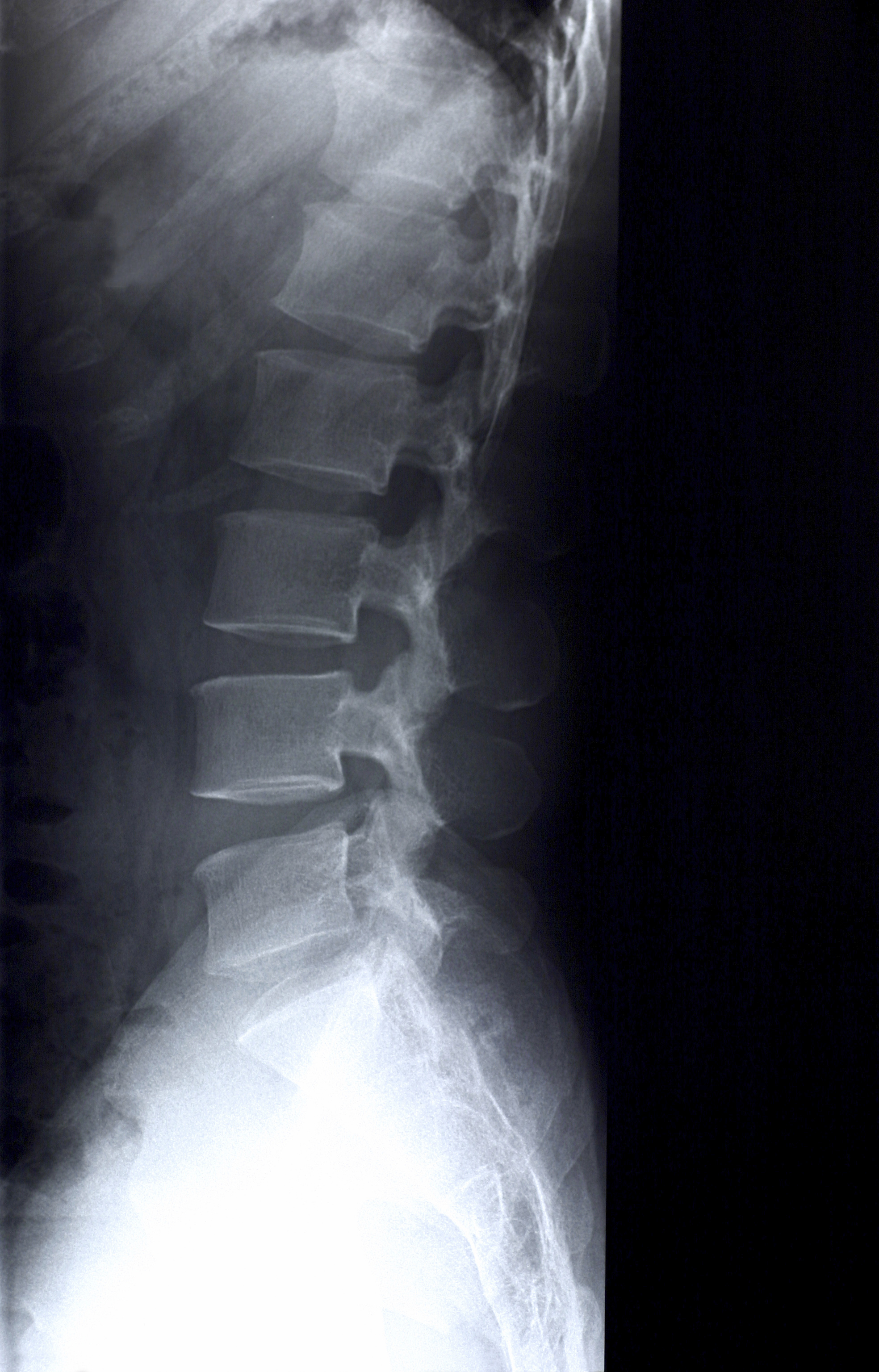 X rays National Institute Of Biomedical Imaging And Bioengineering